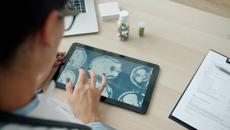 neurology appointment, medical records, symptom diary 📸📸 Realistic top-down photo of medical reports, MRI images and a handwritten symptom diary on a light desk, soft window lighting, clean clinical composition 📸📸 Підготовка документів до консультації невролога